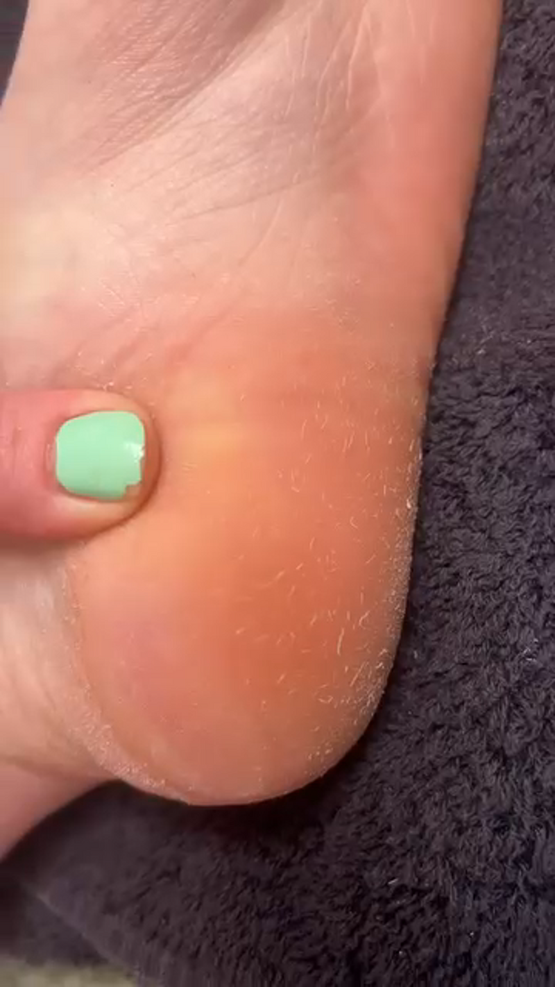 Customer photo